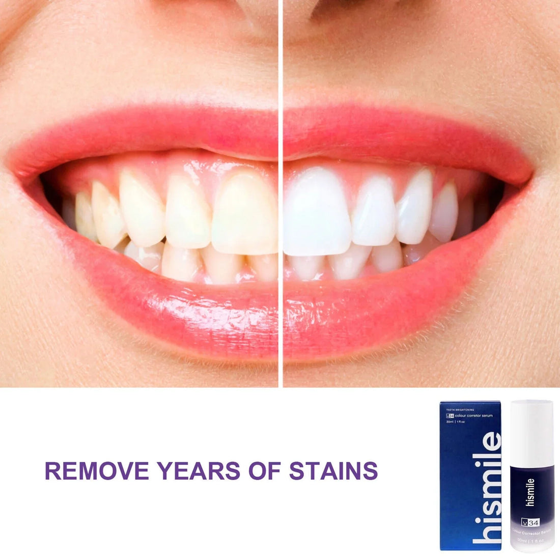 Hismile V34 Purple Teeth Whitening | Colour Corrector Serum 30ml